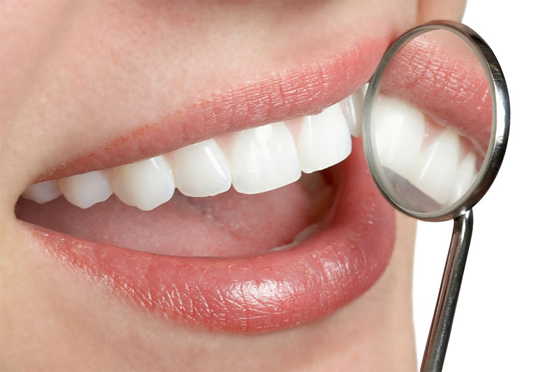 Smiles Dental Dental Offer